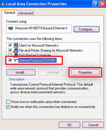 screenshot of local area network properties